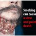 Brit dohányellenes kampány